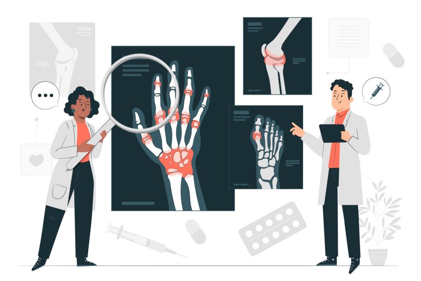 rheumatology-concept-illustration